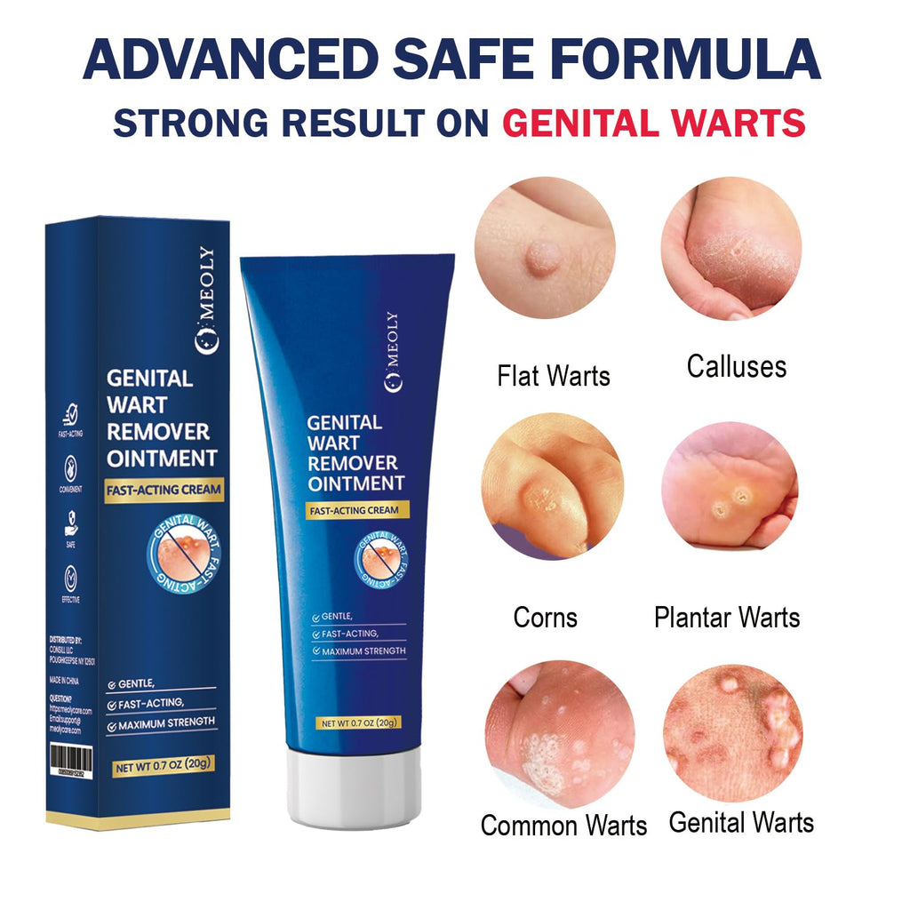Genital Wart Remover Cream 0.7 oz H164